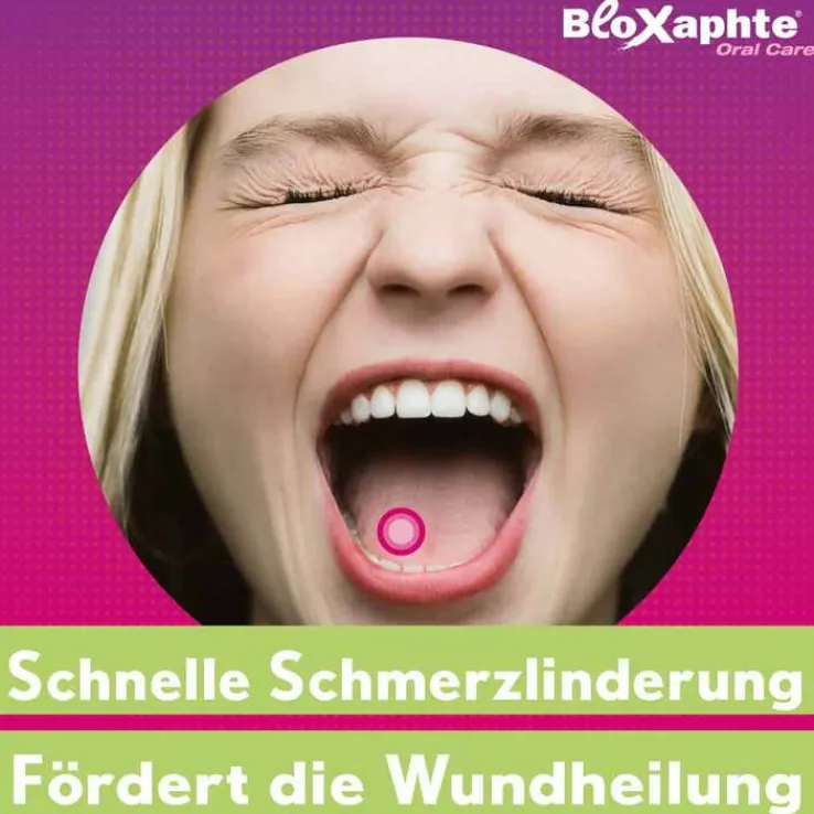 BloXaphte® Oral Care Mundspülung bei Aphthen und Verletzungen im Mund, 100 ml