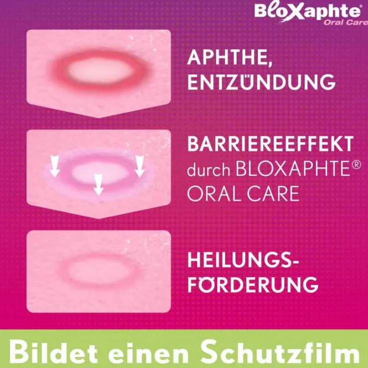 BloXaphte® Oral Care Mundspülung bei Aphthen und Verletzungen im Mund, 100 ml