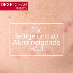Dexeryl Dexeclear Reinigungsgel schäumend für unreine Haut, 200 ml