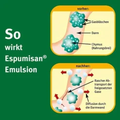 Espumisan Emulsion, 30 ml