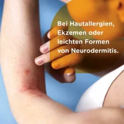 Soventol® HydroCort 0,5% Creme bei akuten Hautentzündungen, 30 g