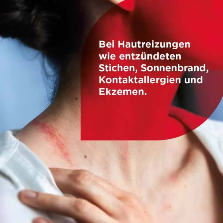 Soventol® HydroCortisonacetat 0,5% Cremogel bei Hautentzündungen, 30 g