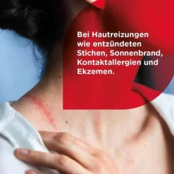 Soventol® Hydrocortisonacetat 0,25% Cremogel bei Hautentzündungen, 20 g